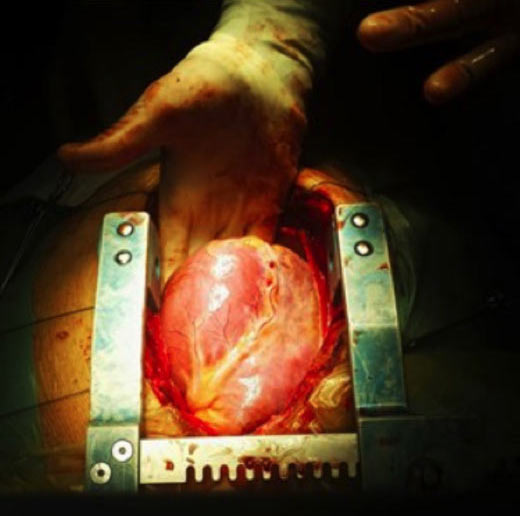 WFTD-3-21-17-Photos-1